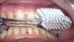 brossage dentaire technique du rouleau dr chevalier dr andrieu dr courtet cabinet parodontie paris 11