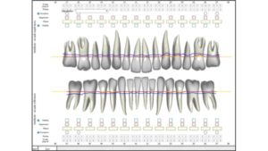 comment se passe un bilan parodontal complet donnees cliniques dr chevalier dr andrieu dr courtet cabinet parodontie paris 11