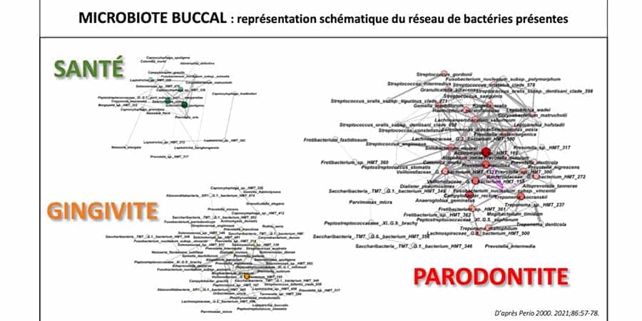 maladie paradontale microbiote buccal cabinet parodontologie paris 11 cabinet parodontie parodontologie paris 11 dr gregoire chevalier et associes