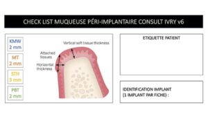 check list muqueuse peri implantaire v6 docteur chevalier gregoire cabinet parodontie paris